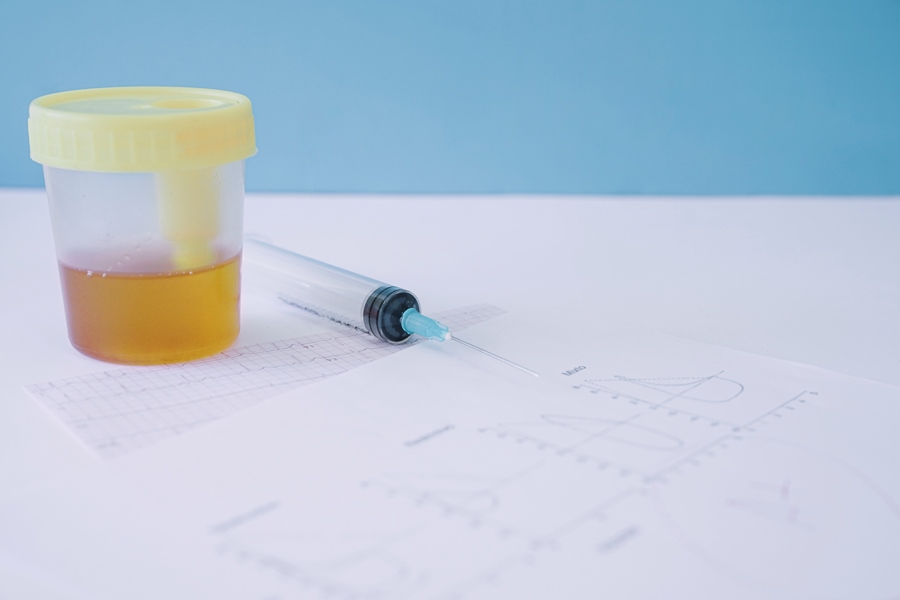 Are At Home Drug Test Accurate How Accurate Are At-Home Drug Tests? | United Recovery Project