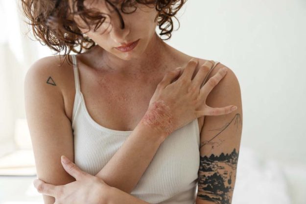 What Are Meth Sores? And How Do You Recognize Them?