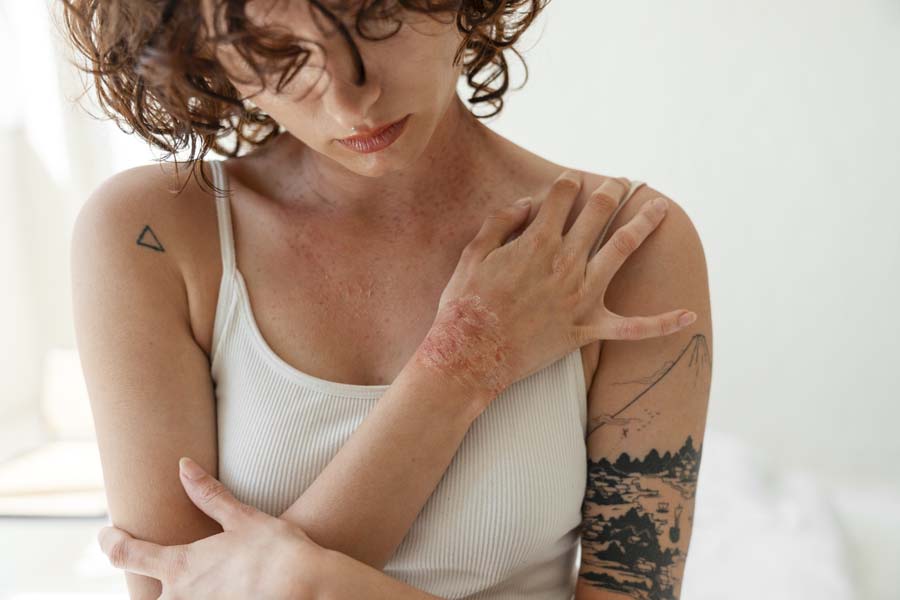 What Are Meth Sores? And How Do You Recognize Them?