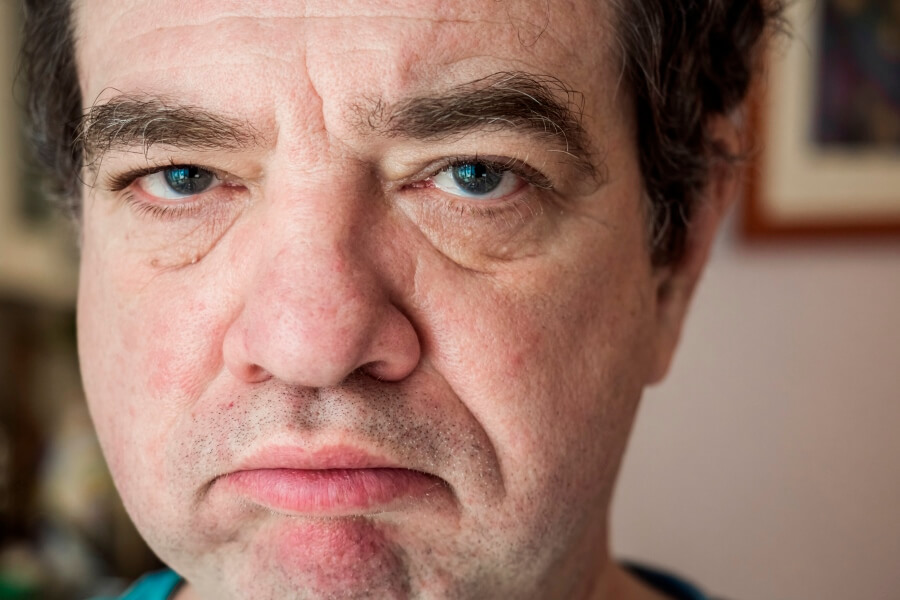 Alcohol Drinker’s Nose: Understanding Rhinophyma